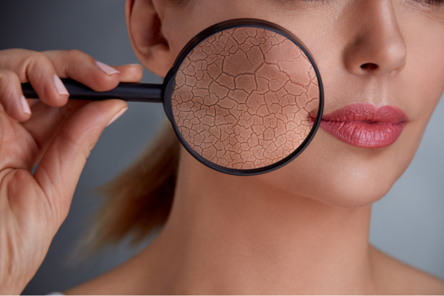 Preenchimento Com Radiesse